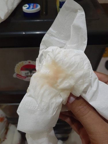 keputihan