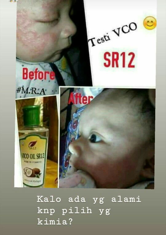 VCO sejuta manfaat
