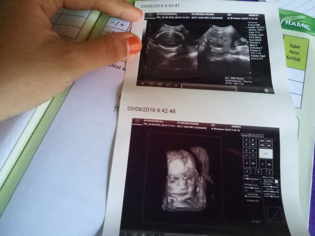 QhodarRudiansyah profile icon