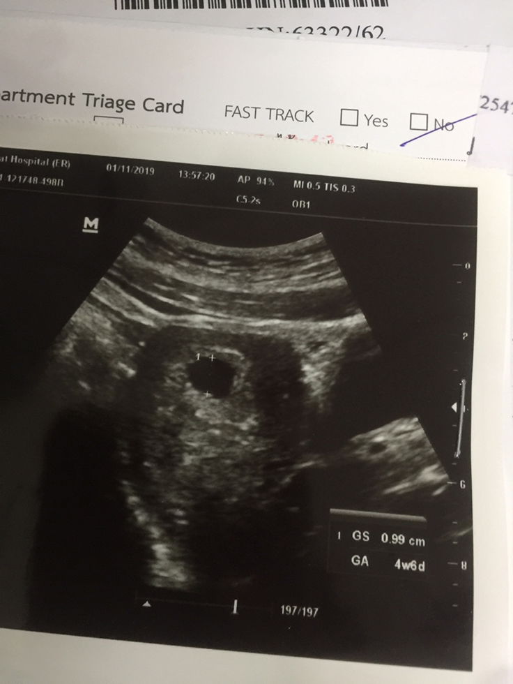 ตั้งแต่หมอซาวเครียดทุกวัน