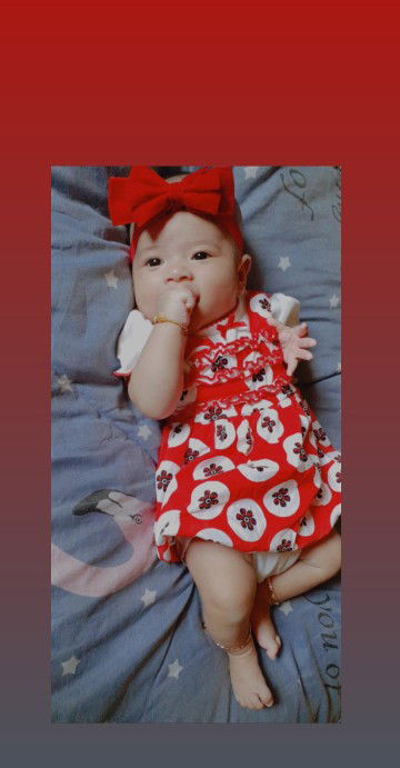 ผ่าคลอดฉุกเฉิน