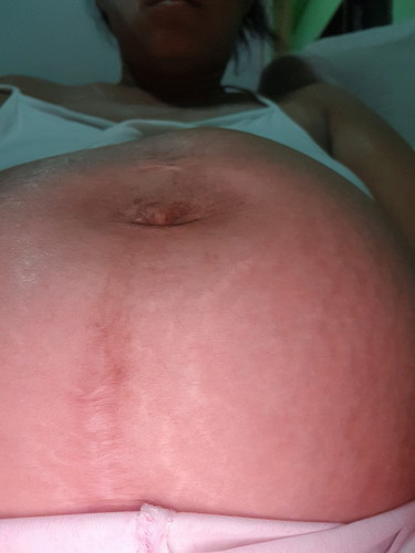 นิดหน่อย