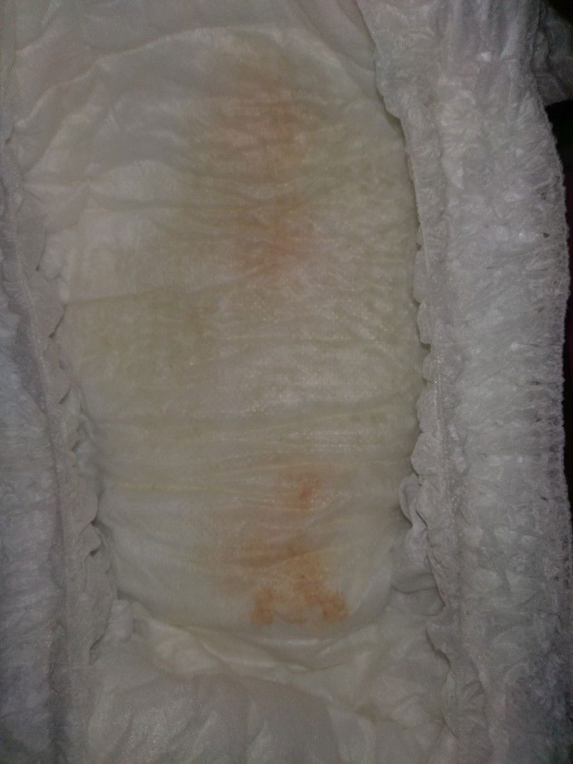 สอบถามหน่อยค่ะ แบบนี้น้องมีปัญหามั๊ยค่ะ