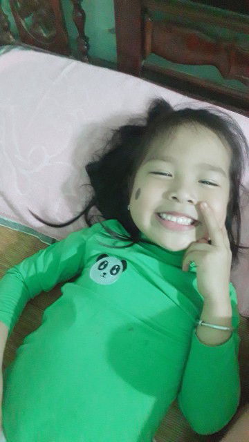 chữa bớt cho bé 4 tuổi