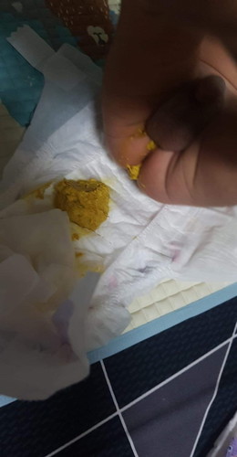 สีอึของลูกแบบนี้ปกติไหม?