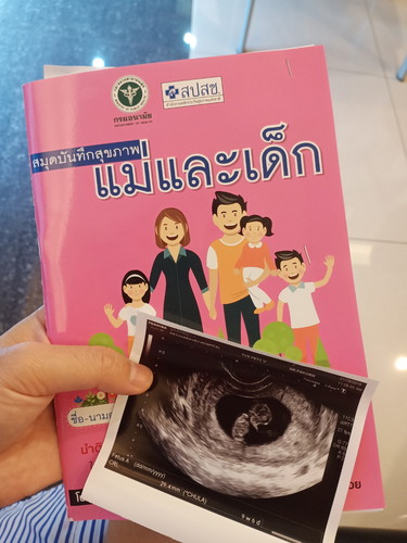 หมอนับสัปดาหฟ์ผิดหรือเรานับไม่เป็นหรือยังไงค่ะ