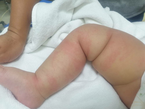 ใข่ตุ๋น..เซเว่น