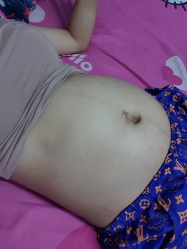 24week แย้ววมีแต่คนทักท้องเล็กท้องไม่ออก