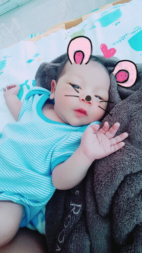 ลูกตาเหลือง