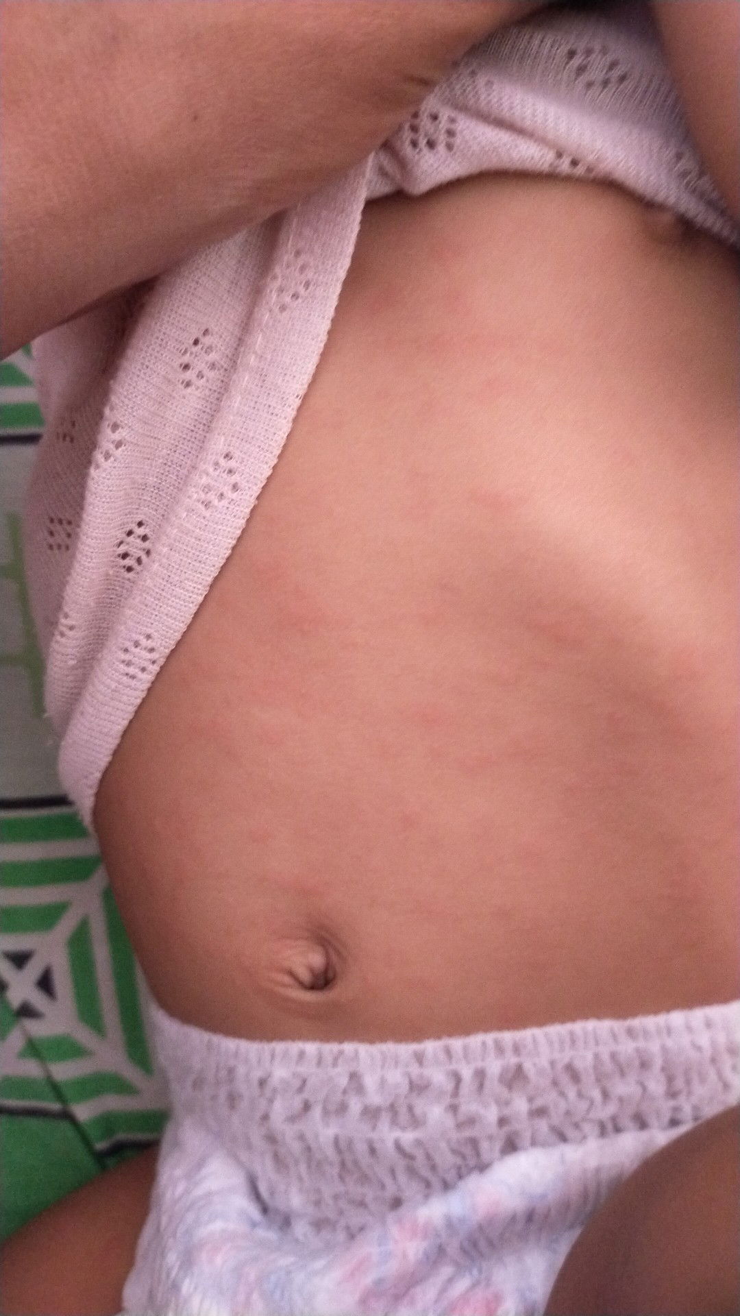 bintik merah seluruh badan