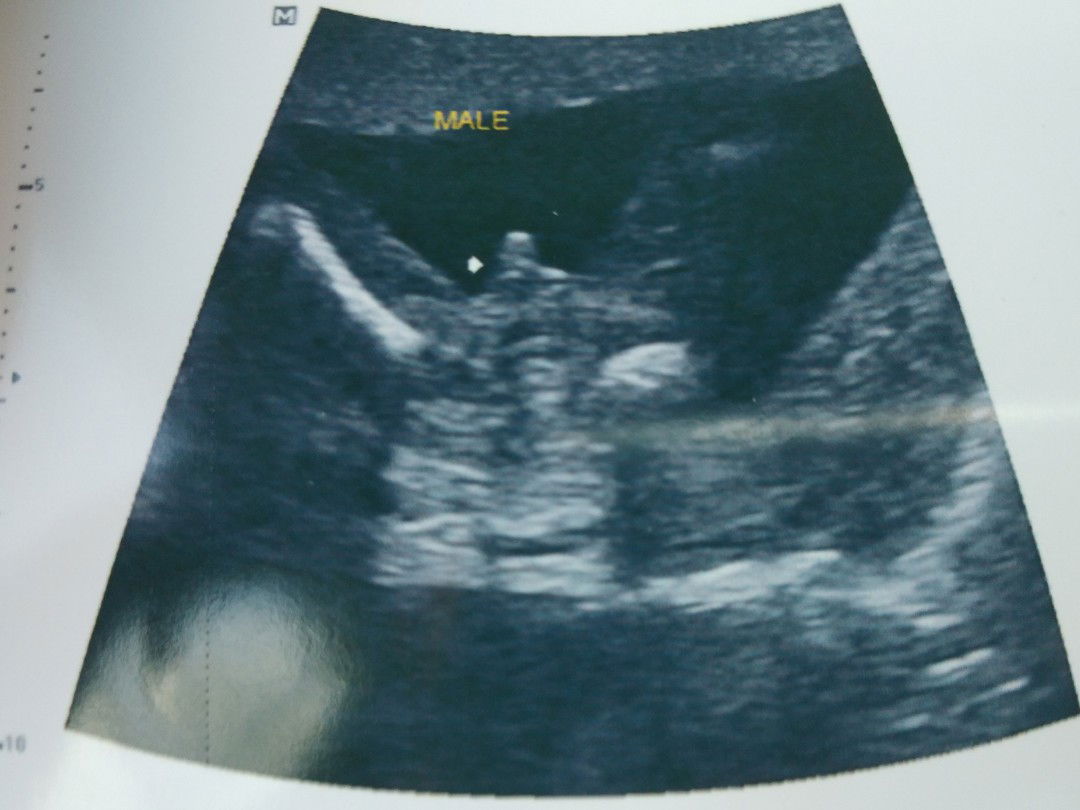 ชัดเจนเลยคะ