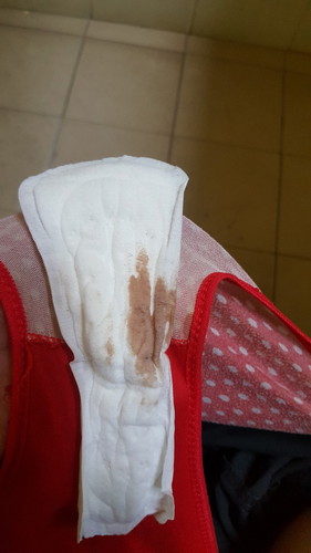 nak tanye siapa pernah kuar darah mcm nie selama 2 minggu.di awal kehamilan 8 minggu..