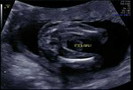 ultrasound huhu