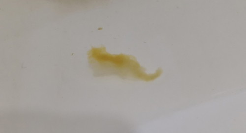 weird discharge
