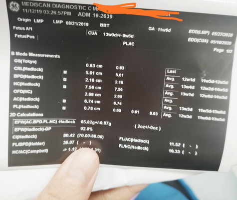 normal size ba?