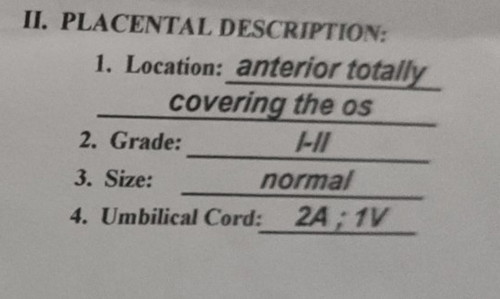 high risk po ba ito?