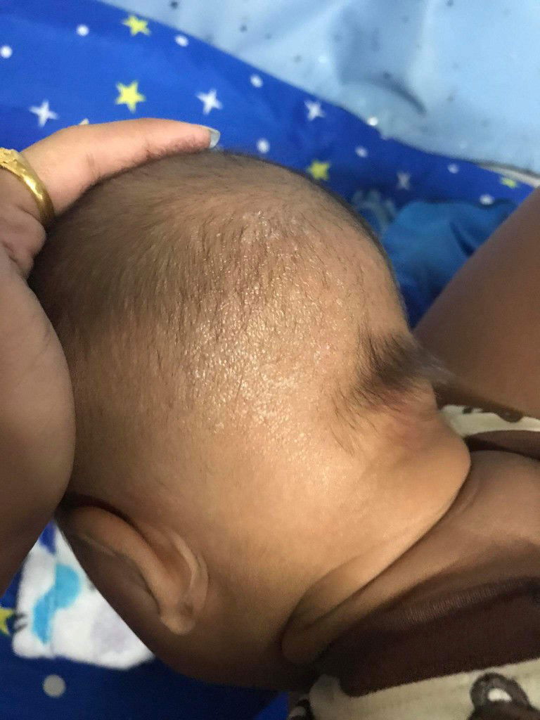 หัวลูกเป็นอะไร