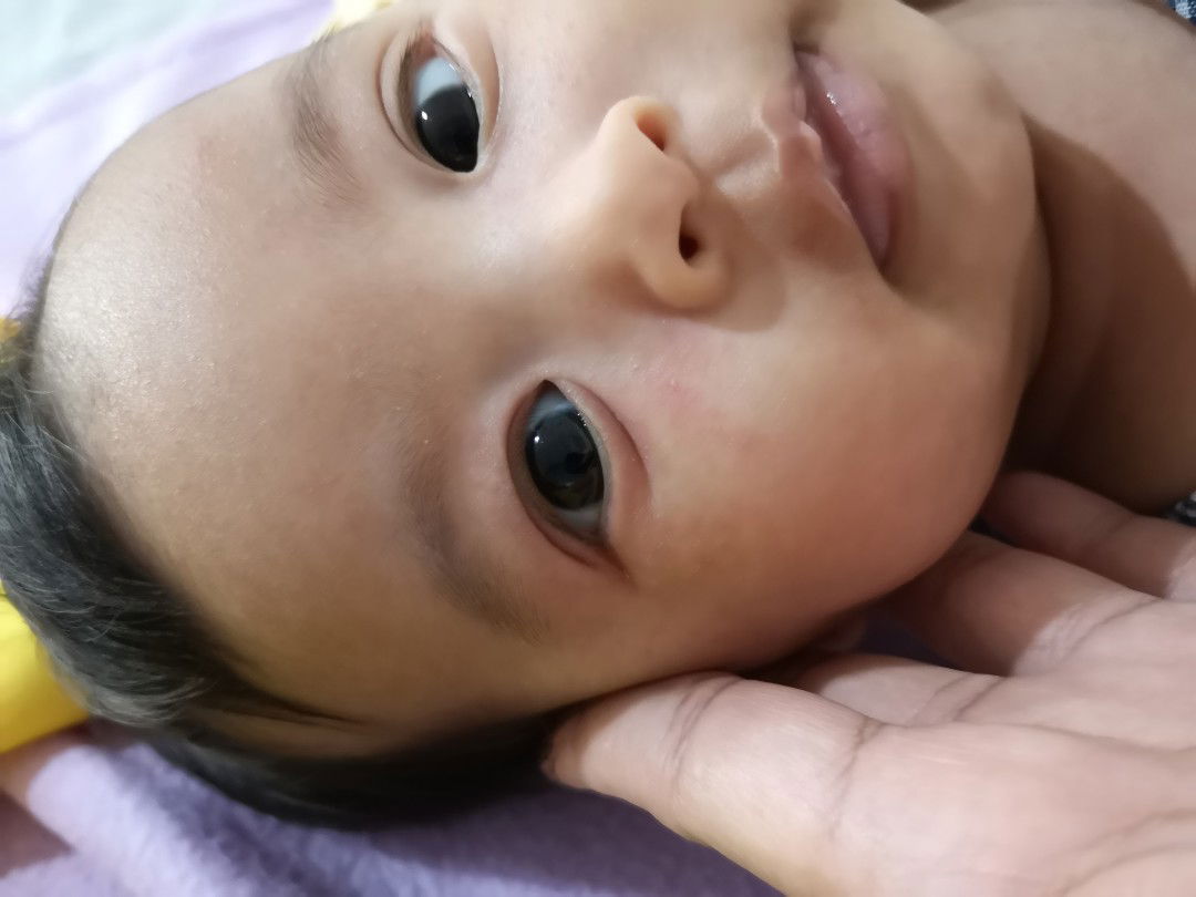 ลูกเป็นผื่น