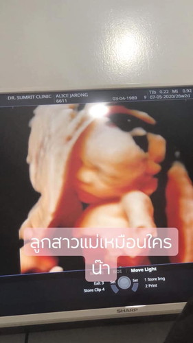 แม่ๆมาอวดรูป หลังคลอดและ4Dกัน