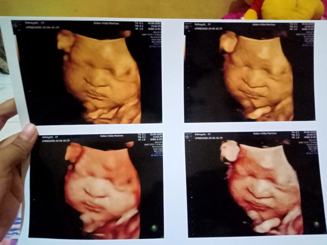 kepengen cepet lahiran