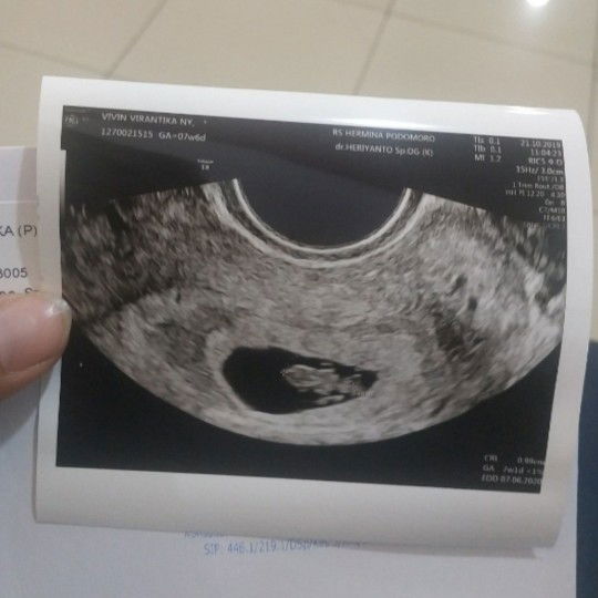 SETELAH DIKATAKAN BO