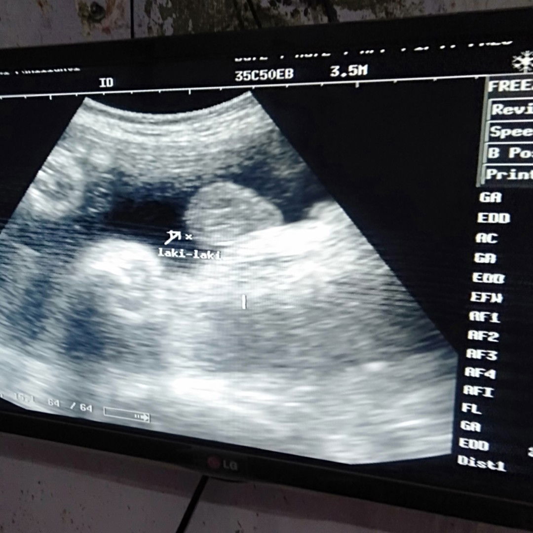 benar ga jk baby boy