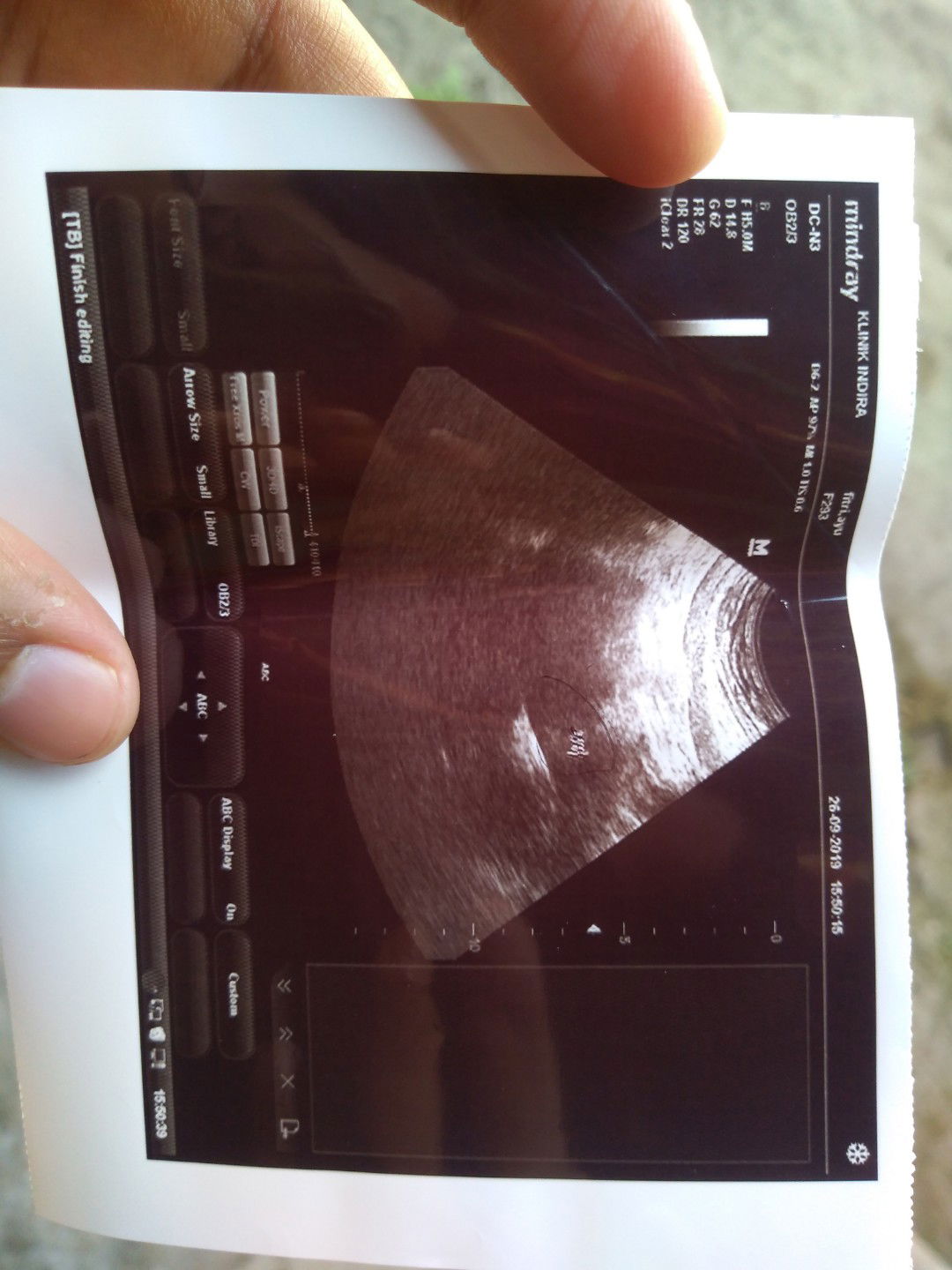 mengetahui umur kandungan