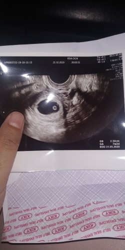 7 weeks