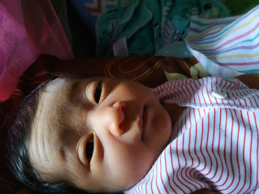 Kelopak Mata Bayi Tebal ( Usia 6 hari )