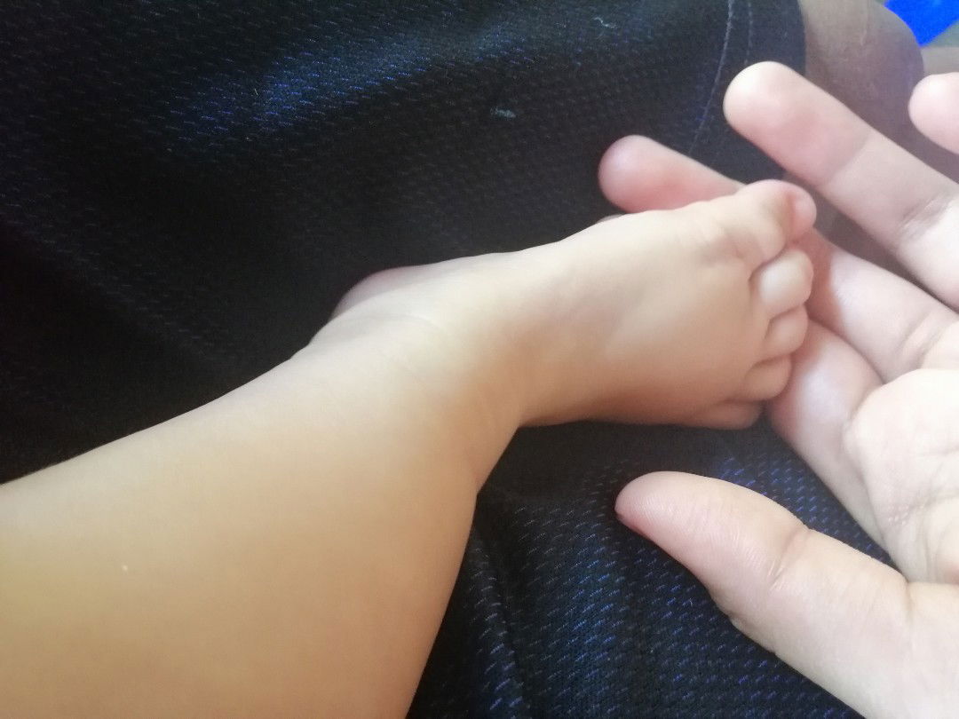 Parang Umumbok Sa May Paa