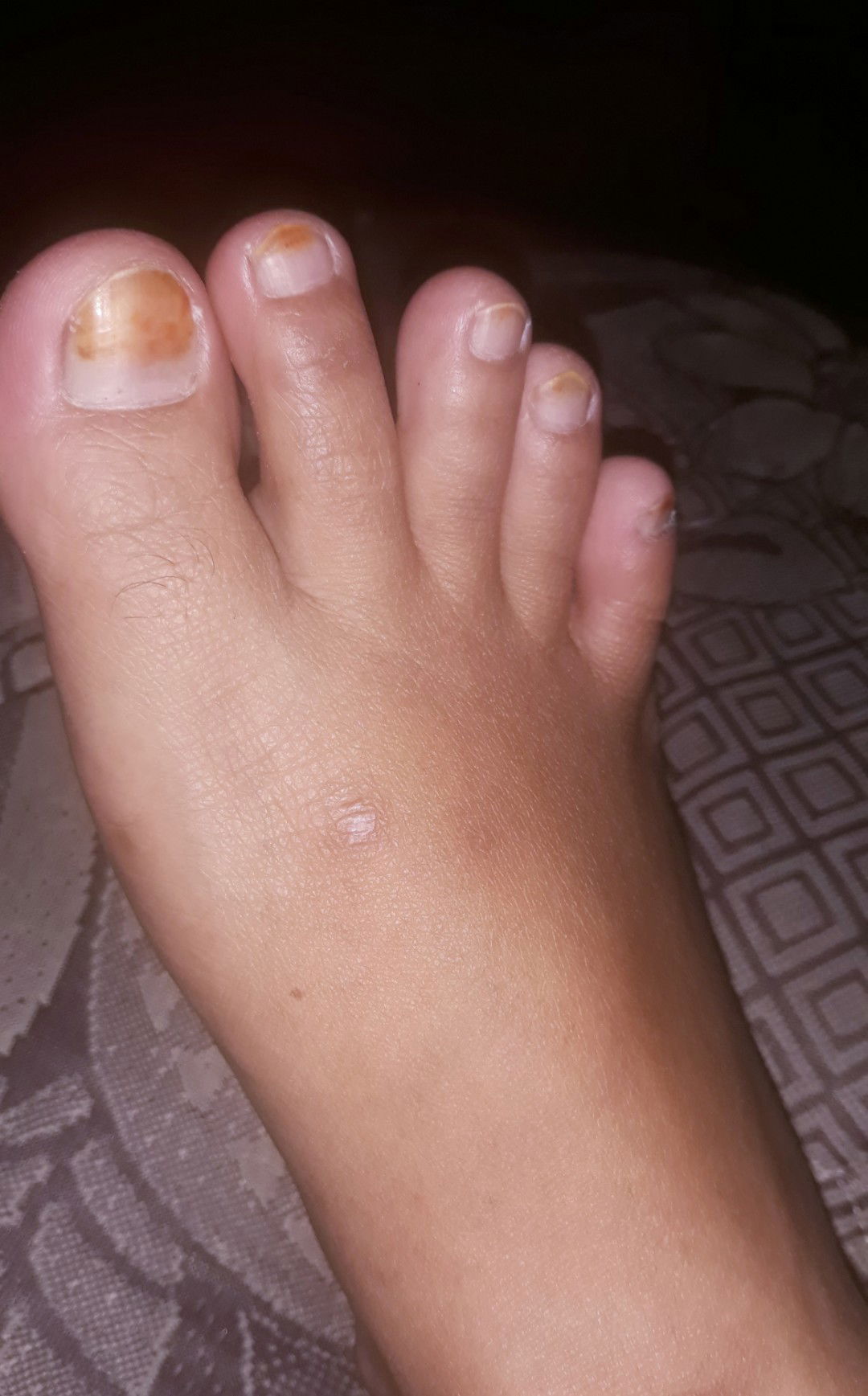 hamil 32w ini bengkak gak ya