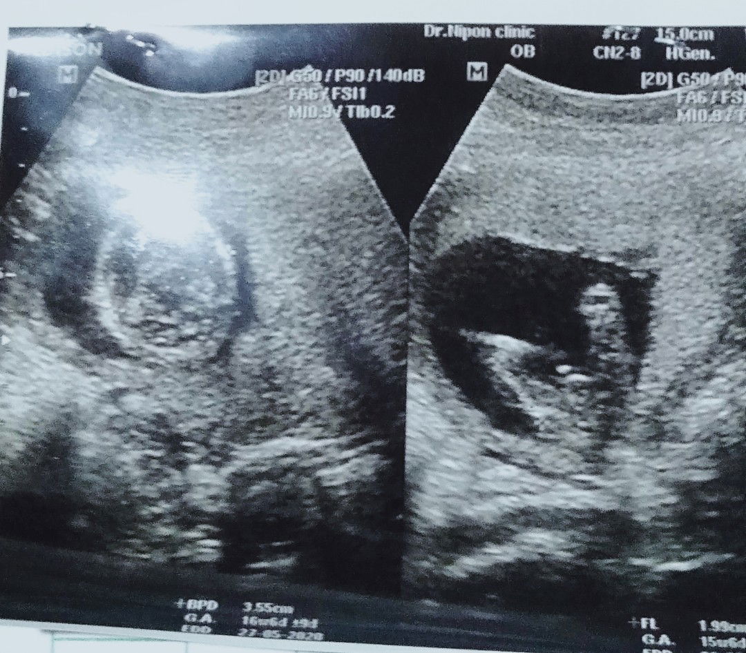 สิ่งที่เสียไปคือนํ้าตา สิ่งที่ได้มาคือบทเรียน profile icon