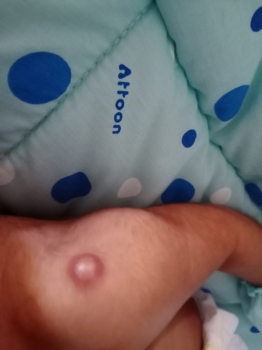 เจาะเลือด