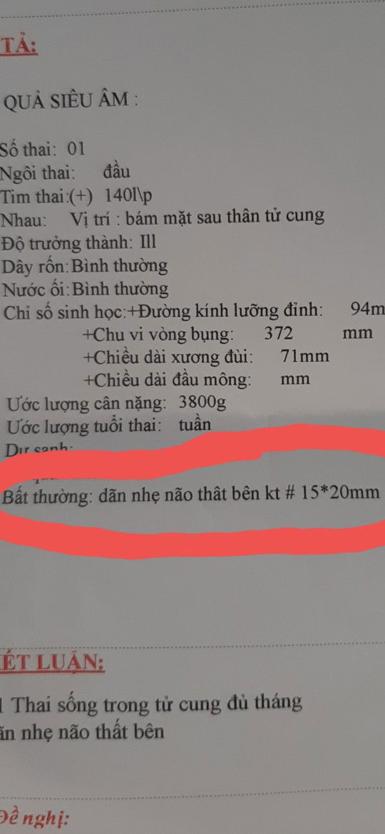 Có mom nào có trường hợp giống m ko ak.