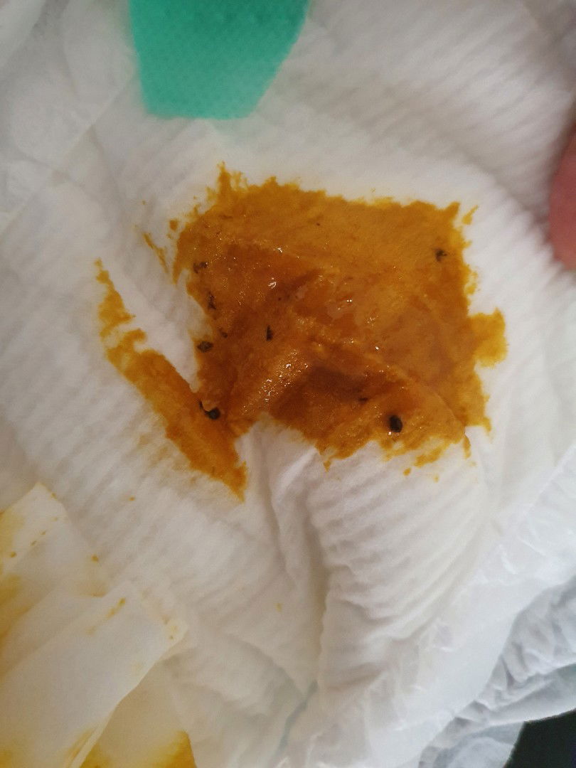 สอบถามเรื่องอึน้องอายุ 1เดือน 26 วันค่า