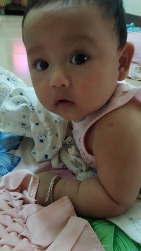 ลูกคว่ำ