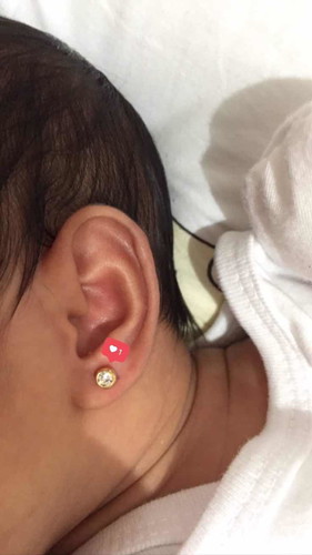 EAR PIERCING