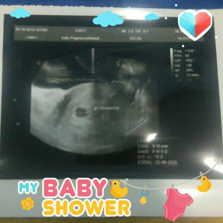 first baby