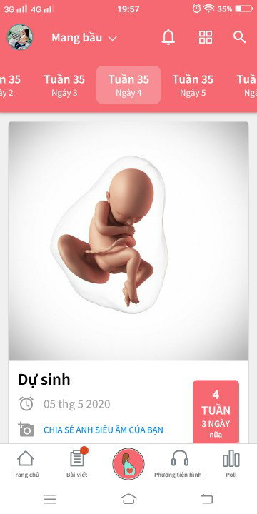 mang thai lần đầu nên ko kn. mong các m tư vấn hộ em với