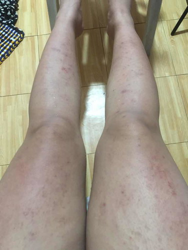 ANYONE NA KAGAYA NG CASE KO?