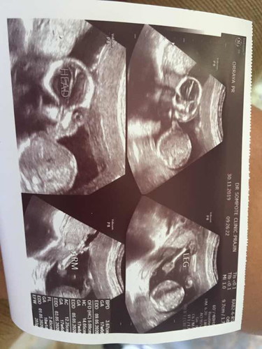ได้ลูกสาวคะ ซาว18w