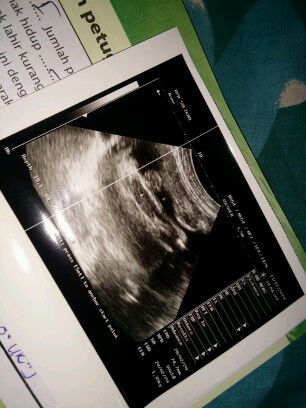 Sofi Alvien Noventi profile icon