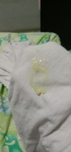 มันคืออะไรค่ะคุณแม่ๆ