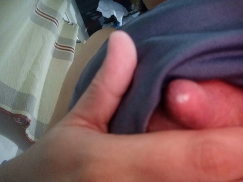 Breastfeed
