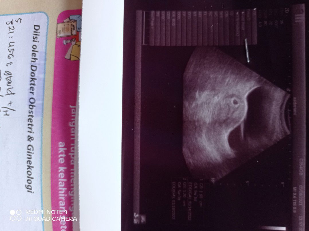 Janin tidak sesuai dengan hpht