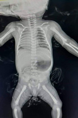 BAYI MEMANG CEPAT LAPAR KALAU MINUM ASI.