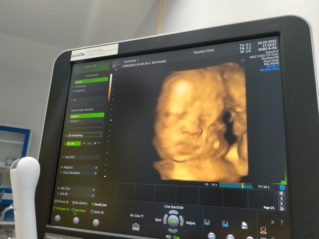 แม่ทีมพฤษภาน้ำหนักขึ้นกันกี่กิโลค่ะ