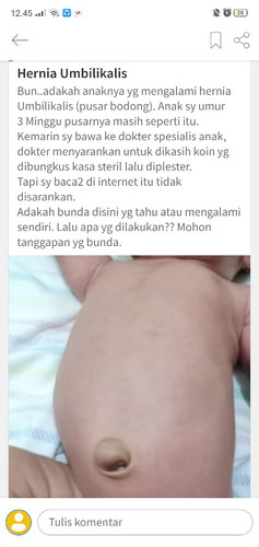 pusar bodong