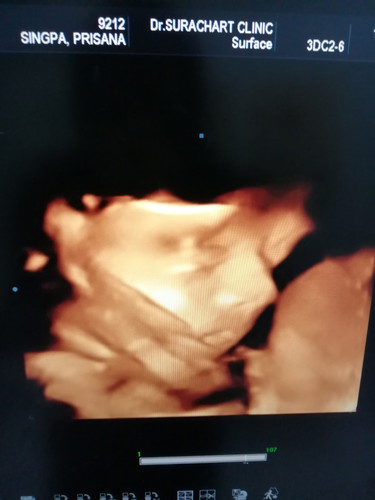 25week.?