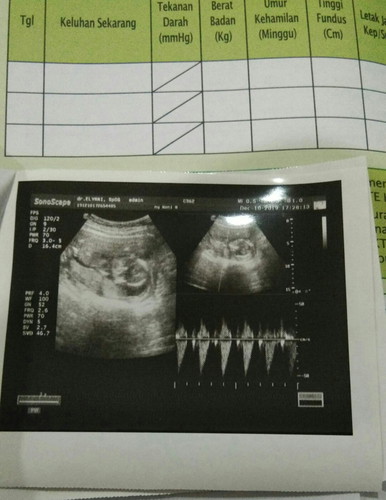 berat badan ibu kurang..